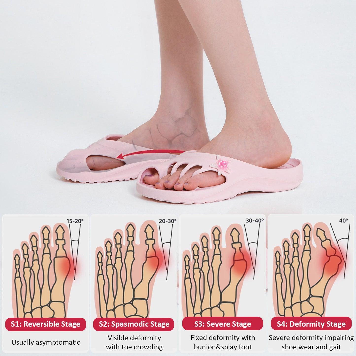 Toe Separator Sandals
